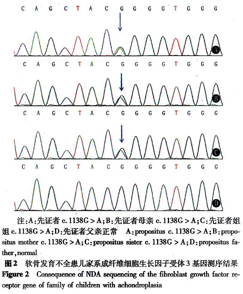 新研究揭示影响软骨韧性的脂肪软骨细胞