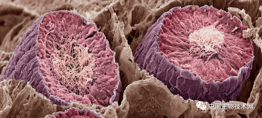 新研究发现南方古猿是素食者