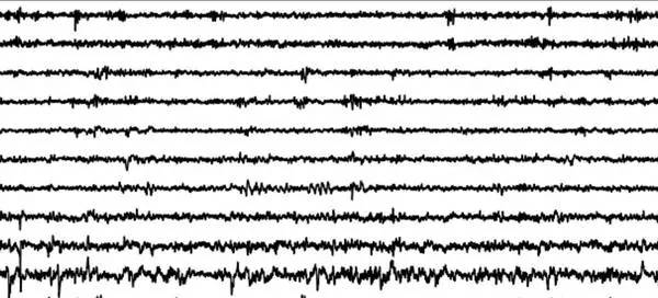 科学家成功解析大脑掌管学习记忆的“分子开关”