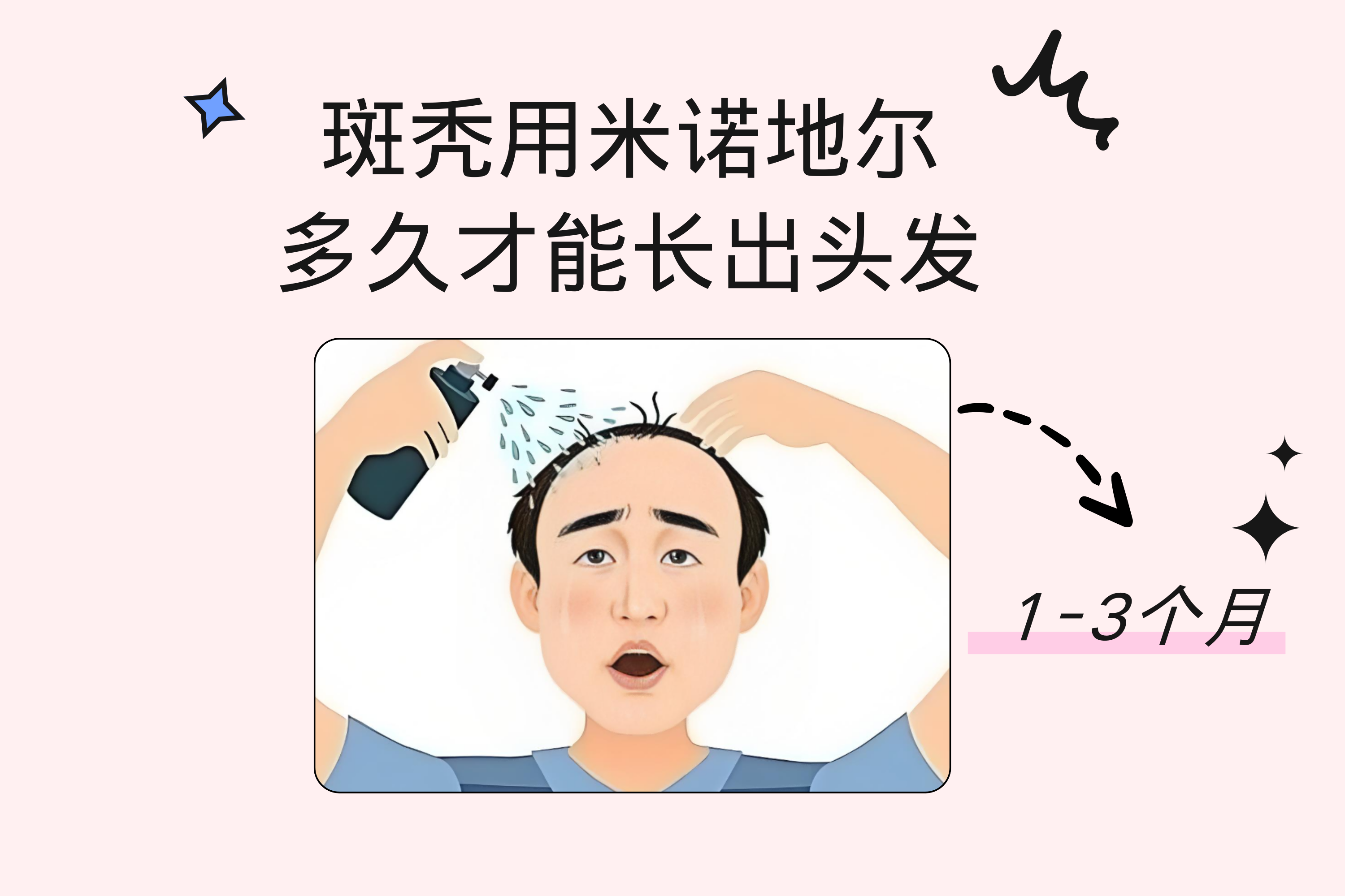 欧加隆推出保法生米诺地尔搽剂 阿里健康首发上线