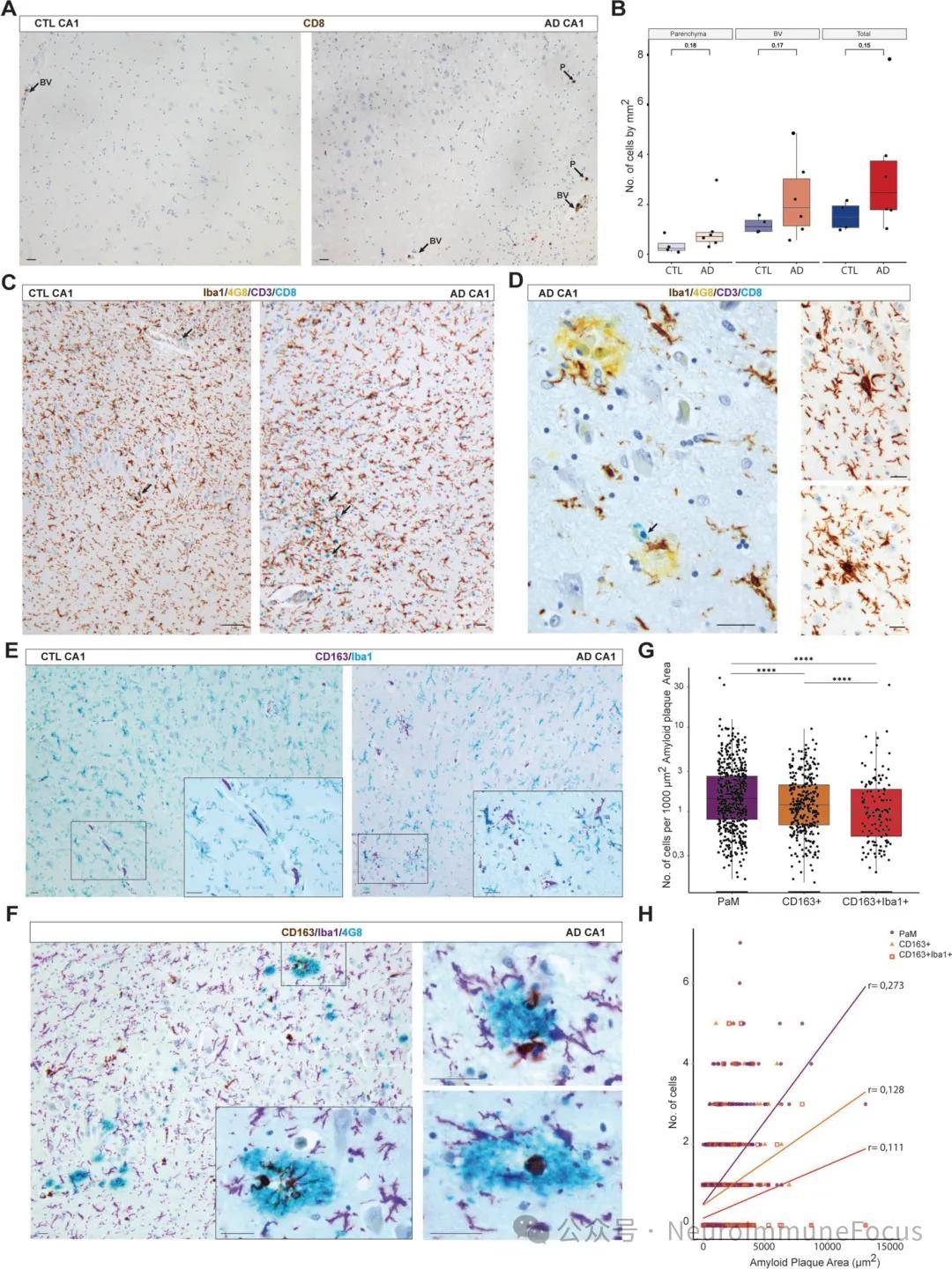 新研究有望为阿尔茨海默病治疗提供新思路