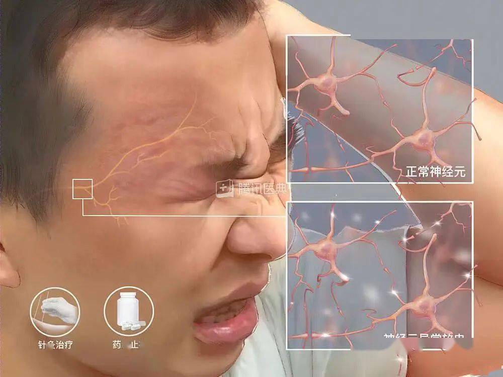 研究：带状疱疹疫苗可能降低心脏病及中风风险